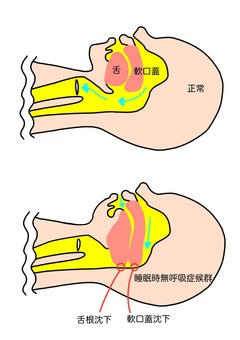 舌の位置
戸田市 | 戸田公園 | 戸田パーソナルジム | 戸田市パーソナルジム | 戸田公園パーソナルジム
