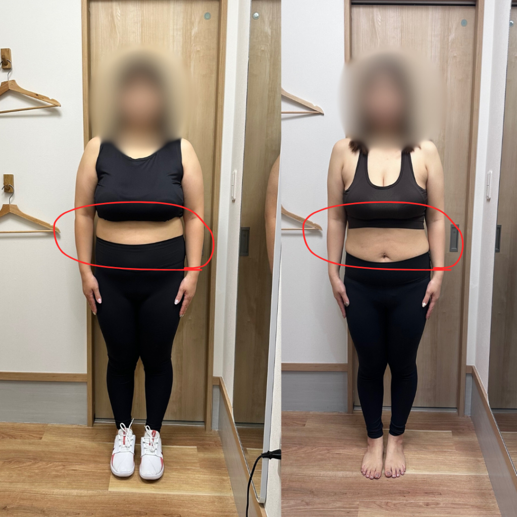 A様ビフォーアフター正面
戸田市 | 戸田公園 | 戸田パーソナルジム | 戸田市パーソナルジム | 戸田公園パーソナルジム