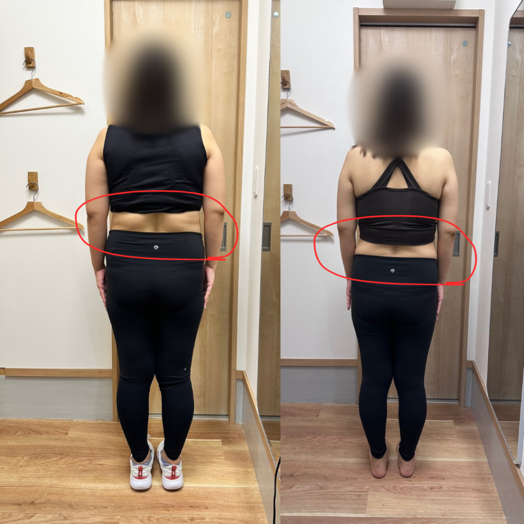 A様ビフォーアフター後ろ
戸田市 | 戸田公園 | 戸田パーソナルジム | 戸田市パーソナルジム | 戸田公園パーソナルジム